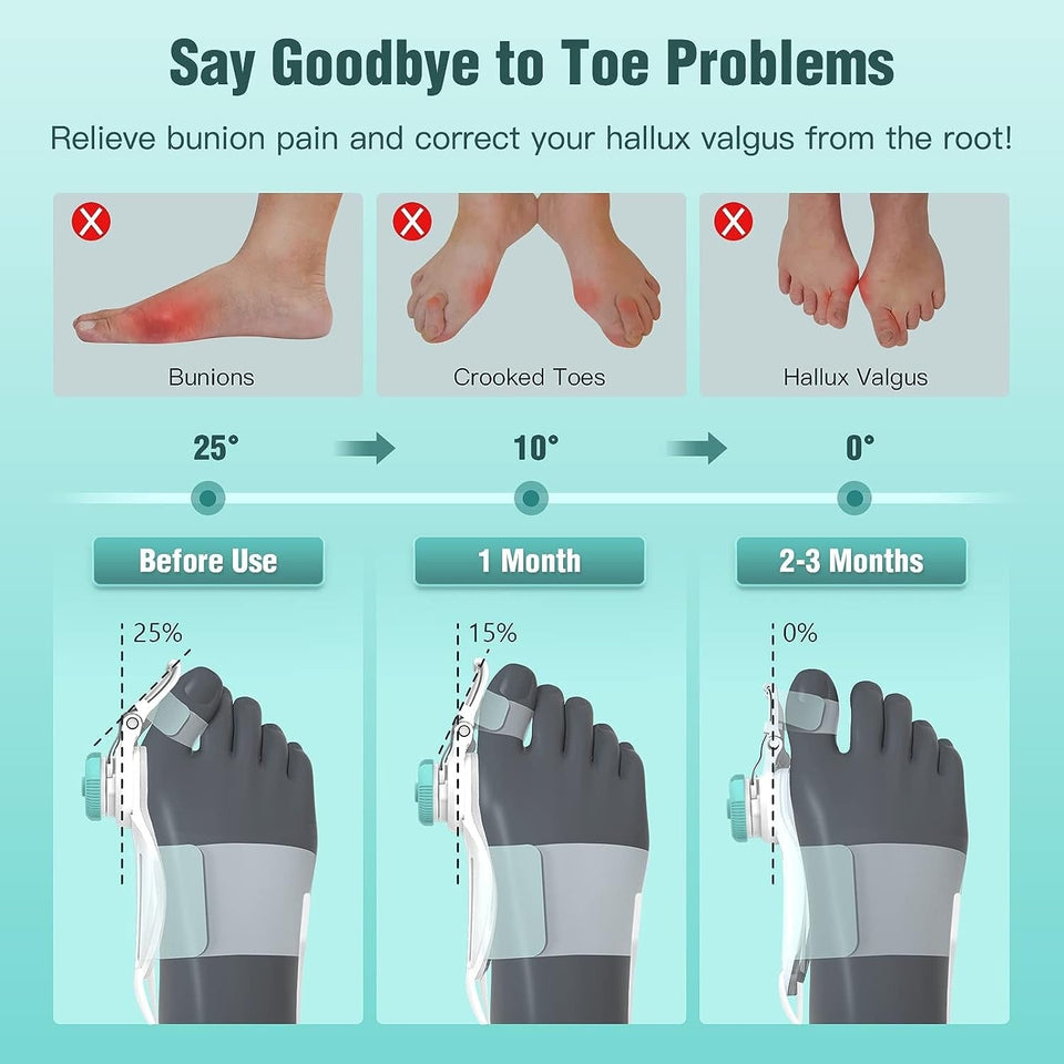 FLEXIBLE BUNION CORRECTOR
