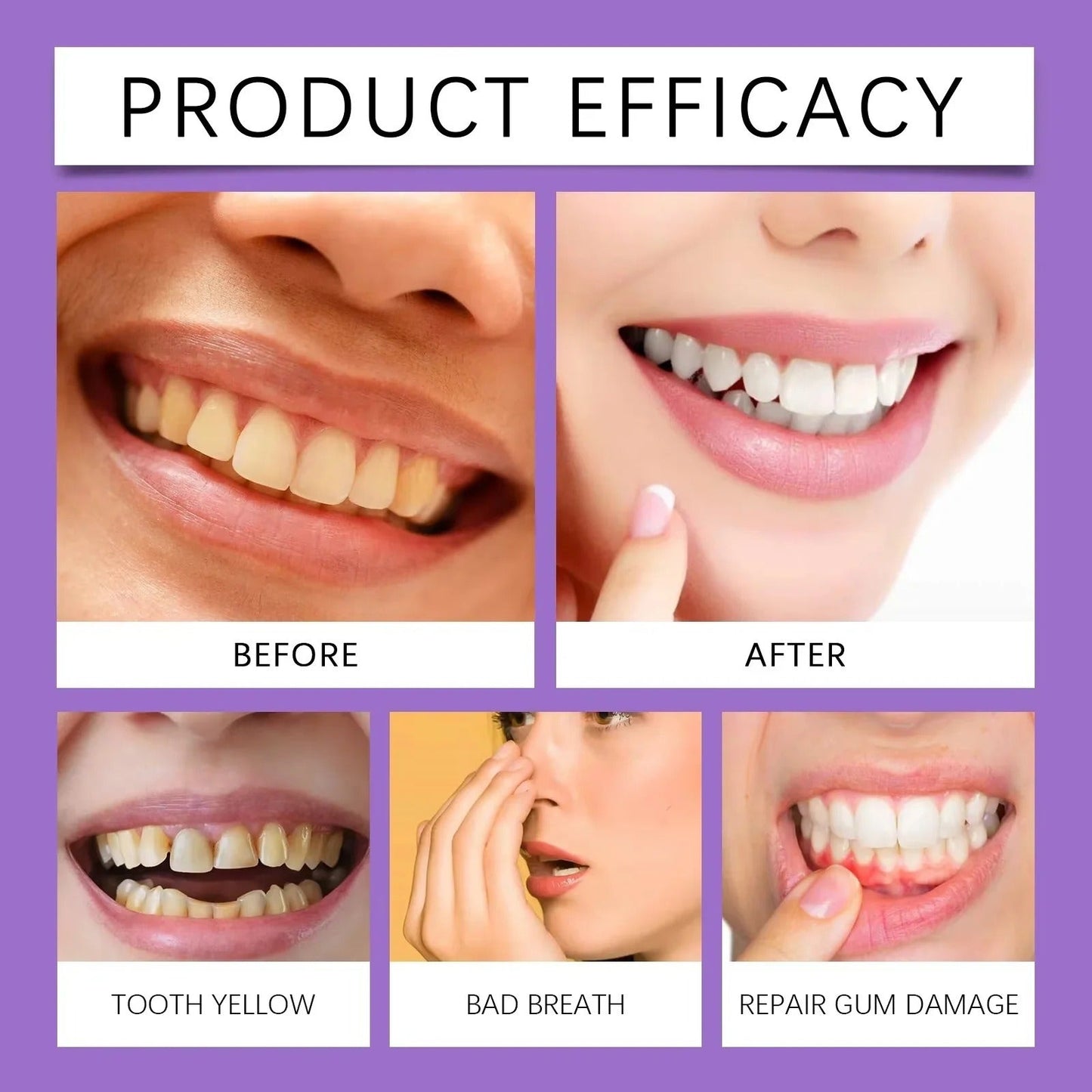 Teeth Whitening Strips