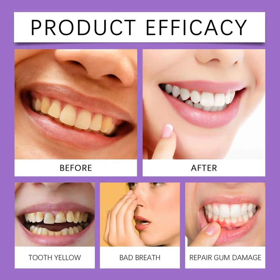 Teeth Whitening Strips