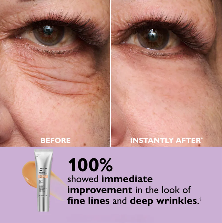 Instant Eye Tightener